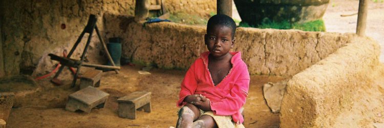 Joachim, un niño traficado de Benin