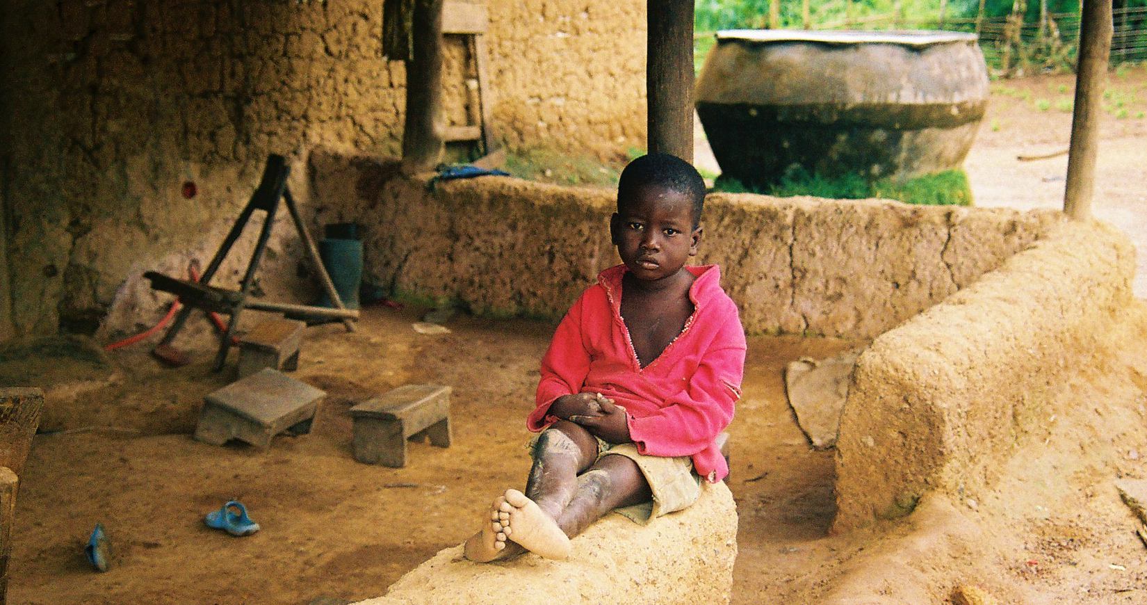 Joachim, un niño traficado de Benin