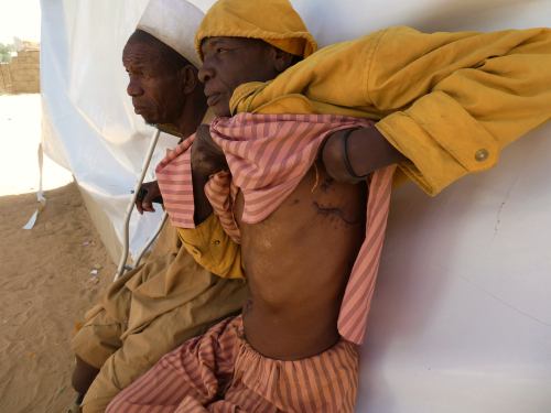 Una víctima de Boko Haram enseña las lesiones que le provocaron en Maiduguri